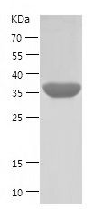    PON1 / Recombinant Human PON1