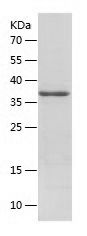    APE1 / Recombinant Human APE1