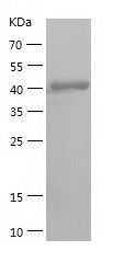    Calreticulin / Recombinant Human Calreticulin