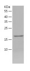    Proteasome 20S LMP2 / Recombinant Human Proteasome 20S LMP2