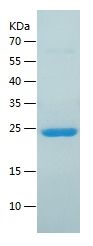    Proteasome 20S beta 6 / Recombinant Human Proteasome 20S beta 6