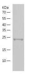    LOX / Recombinant Human LOX