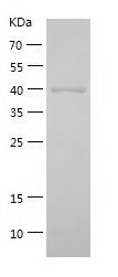    ADH6 / Recombinant Human ADH6