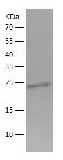    Grancalcin / Recombinant Human Grancalcin