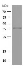    CD30 / Recombinant Human CD30