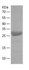    CD1b / Recombinant Human CD1b