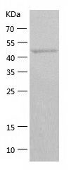    TFIIE alpha / Recombinant Human TFIIE alpha