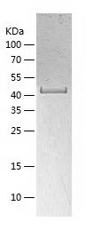    SerpinB3 / Recombinant Human SerpinB3