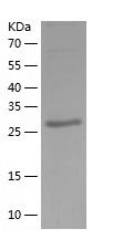 Recombinant VCAM1 mouse