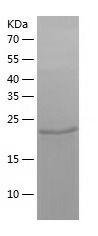    Nucleoside-diphosphate kinase / Recombinant Human Nucleoside-diphosphate kinase