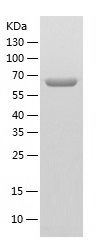    PPP2R1A / Recombinant Human PPP2R1A