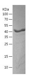    RRM2 / Recombinant Human RRM2