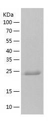    FGF9 / Recombinant Human FGF9