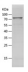    AKT1 / Recombinant Human AKT1