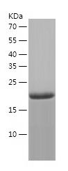    CD32B / Recombinant Human CD32B