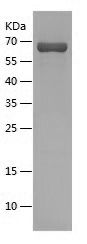    Cystathionase / Recombinant Human Cystathionase