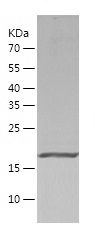    dUTPase / Recombinant Human dUTPase