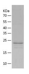    PRSS3 / Recombinant Human PRSS3