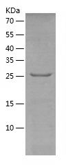    Carbonic Anhydrase 8 / Recombinant Human Carbonic Anhydrase 8