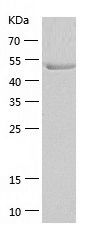    Glucokinase / Recombinant Human Glucokinase