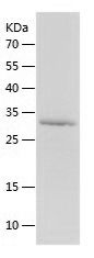    DDIT3 / Recombinant Human DDIT3