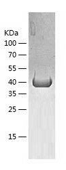    Cytokeratin 20 / Recombinant Human Cytokeratin 20