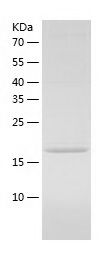    SRP14 / Recombinant Human SRP14