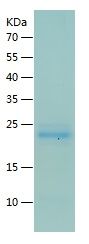    VILIP3 / Recombinant Human VILIP3