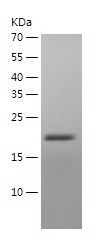    TAGLN2 / Recombinant Human TAGLN2