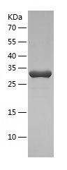    Transaldolase 1 / Recombinant Human Transaldolase 1