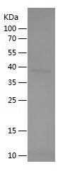    Thrombopoietin / Recombinant Human Thrombopoietin