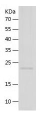 Recombinant Mouse Thrombopoietin