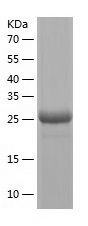    NNMT / Recombinant Human NNMT