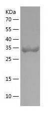    MDH1 / Recombinant Human MDH1