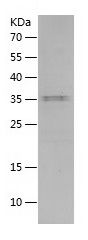    IL-15 / Recombinant Human IL-15