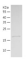    Centrin 2 / Recombinant Human Centrin 2