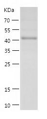    MNDA / Recombinant Human MNDA