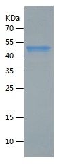    Wnt5a / Recombinant Human Wnt5a