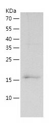    LAP2 / Recombinant Human LAP2