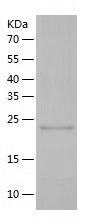    STAT6 / Recombinant Human STAT6