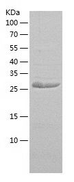    Carbonic Anhydrase 7 / Recombinant Human Carbonic Anhydrase 7