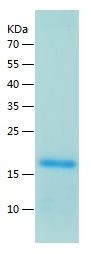    GLP1R / Recombinant Human GLP1R