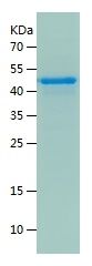    RAD52 / Recombinant Human RAD52