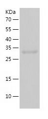    MAGEA4 / Recombinant Human MAGEA4