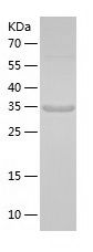    MAGEA6 / Recombinant Human MAGEA6