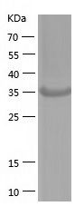    MAGEA10 / Recombinant Human MAGEA10