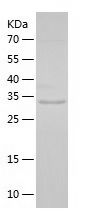 Recombinant Mouse Aldose reductase