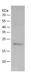    MMP13 / Recombinant Human MMP13