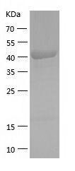    SBCAD / Recombinant Human SBCAD