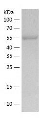 Recombinant Mouse ALDH2